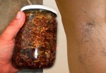 Revolucionarni prirodni tretman za proširene vene: Ulje i mast od nevena