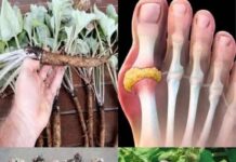 Moćna biljka koja može pomoći u liječenju raka: Detaljniji pogled na blagodati korijena čička