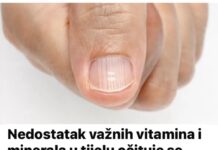 Nedostatak važnih vitamina i minerala u tijelu očituje se vrlo jasnim simptomima! Ali malo ljudi zna da ih muči ovaj problem, NAUČITE IH PREPOZNATI