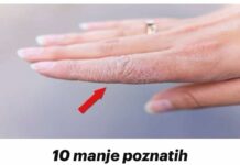 10 manje poznatih SIMPTOMA koji ukazuju na to da štitna žlijezda nije dobro.