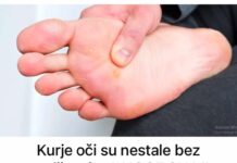 Kurje oči su nestale bez spaljivanja, A NOGE SU MI MEKE KAO KOD BEBE: Najbrža pomoć, a djeluje i na bradavice!